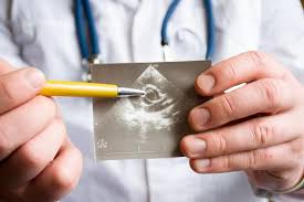 Conferencia:Valvulopatía mitral  vs compromiso pulmonar.